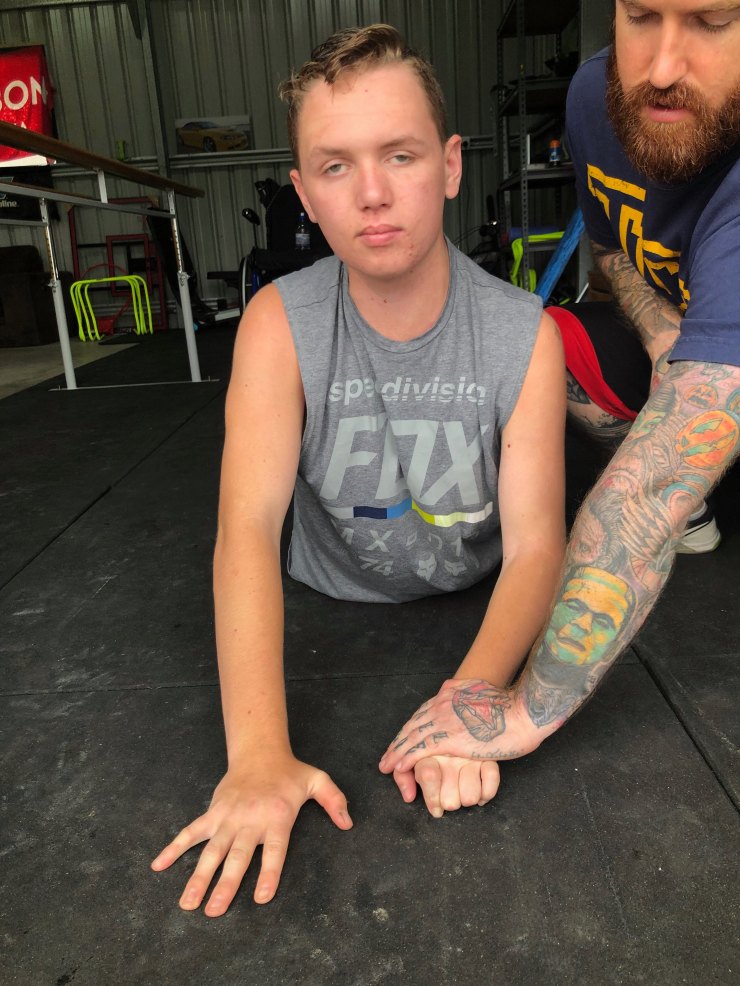 Rehabilitation and NDIS